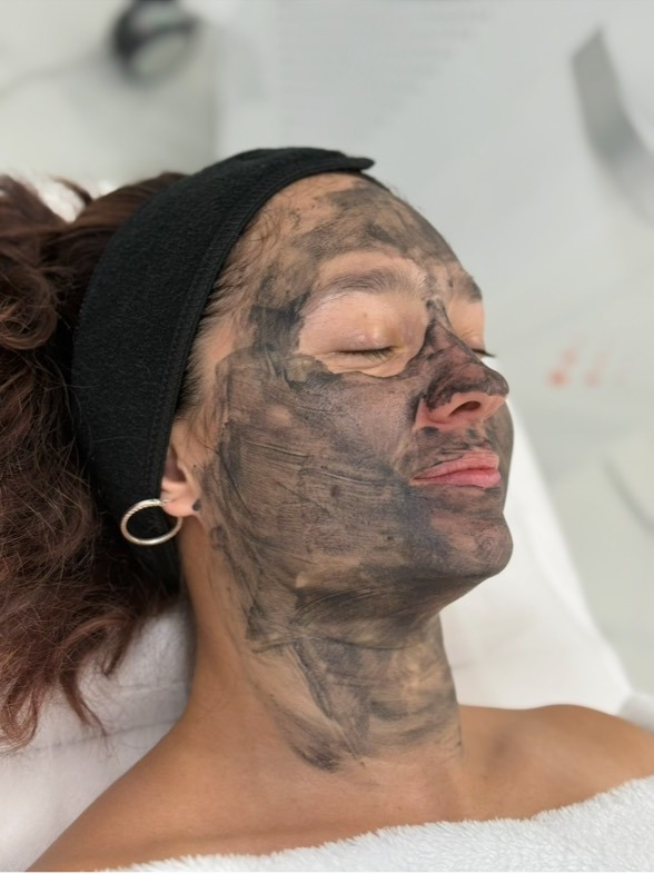Carbon facial treatment in progress