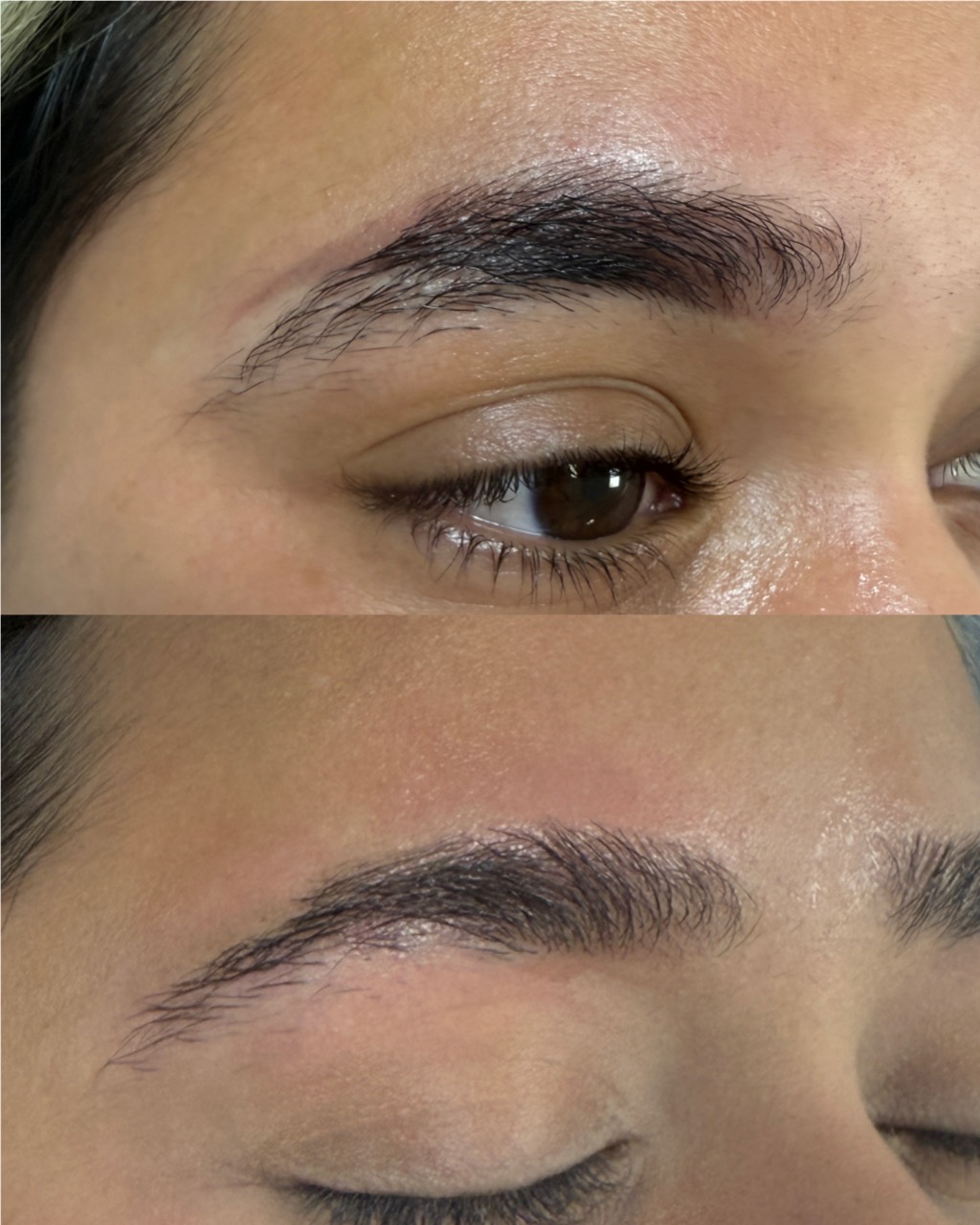 Eyebrow permanent makeup removal before and after progress